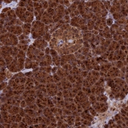 NBP1-87957 - ESCO1