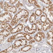 NBP1-84625 - ELP3