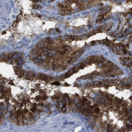 NBP1-91869 - Embigin