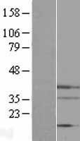 NBL1-10264 - Endo G Lysate