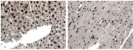 NB110-93604 - EPHA4