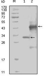 NBP1-47380 - EPHA4