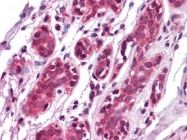NBP1-47425 - EPHA7