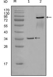 NBP1-47425 - EPHA7