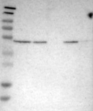 NBP1-89940 - EPSTI1