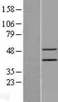 NBL1-10305 - Epithelial Stromal Interaction 1 Lysate