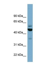 NBP1-58223 - TUBE1