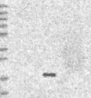 NBP1-85890 - ESM1