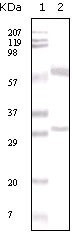 NB100-2179 - Estrogen receptor alpha