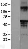 NBL1-10345 - Estrogen Receptor beta Lysate