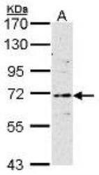NBP1-41192 - Estrogen receptor alpha