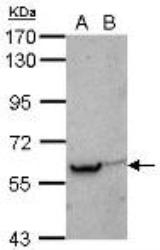 NB200-304 - Estrogen receptor beta