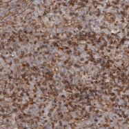 NBP1-89607 - XPO5 / Exportin-5