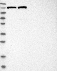NBP1-89605 - XPO5 / Exportin-5