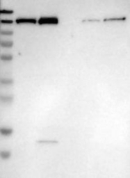 NBP1-89606 - XPO5 / Exportin-5