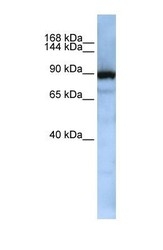 NBP1-57176 - XPOT / Exportin-T
