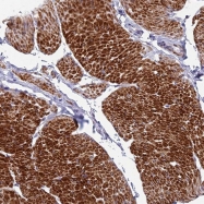 NBP1-93539 - LOC51252