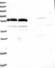 NBP1-93539 - LOC51252