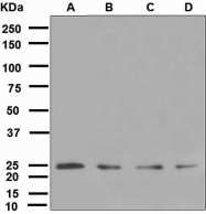 NBP1-95481 - Ubiquitin D (UBD)