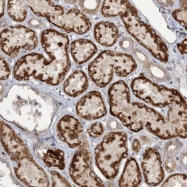 NBP1-86256 - Zygin-1