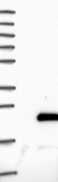 NBP1-86256 - Zygin-1
