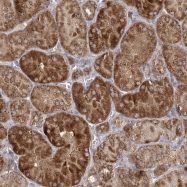 NBP1-90909 - Zygin-2