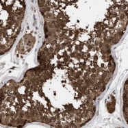 NBP1-84679 - Fat-inducing protein 1 / FIT1