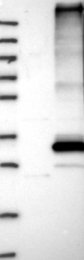 NBP1-84679 - Fat-inducing protein 1 / FIT1
