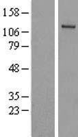 NBL1-17501 - FLJ10808 Lysate