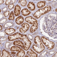 NBP1-91905 - TMEM231
