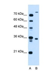 NBP1-59823 - TMEM231