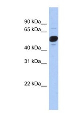 NBP1-52962 - FRS3