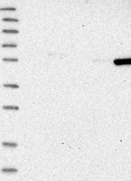 NBP1-83421 - FRS3