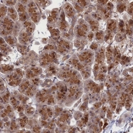 NBP1-81123 - FSD1