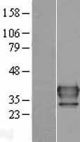 NBL1-13490 - FUS2 Lysate