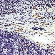 NBP1-22620 - von Willebrand factor (VWF)