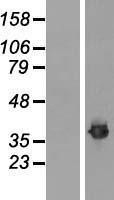 NBL1-10607 - Fibrillarin Lysate