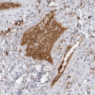 NBP1-87448 - Fibrinogen gamma chain