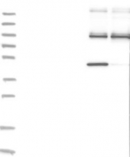NBP1-87448 - Fibrinogen gamma chain