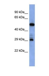 NBP1-69363 - Folate receptor alpha