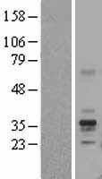 NBL1-10790 - Folate Binding Protein Lysate
