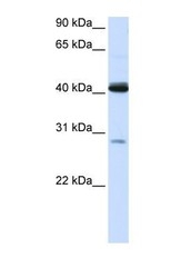 NBP1-54641 - GCD / GCDH