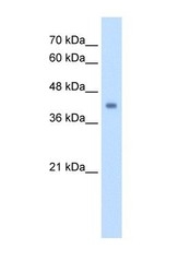 NBP1-54737 - GCD / GCDH