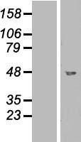 NBL1-11003 - GCDH Lysate