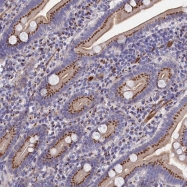 NBP1-90313 - TUBGCP4