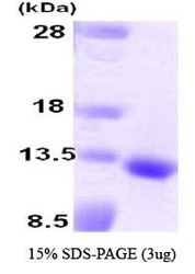 NBC1-28772 - BMP3B / GDF10