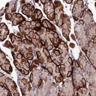NBP1-91934 - BMP13 / GDF6
