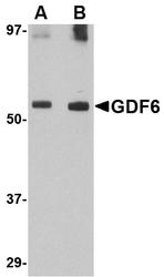 NBP1-76364 - BMP13 / GDF6