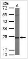 NBP1-31466 - Glyoxalase I / GLO1