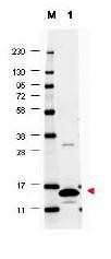 NBP1-42743 - GM-CSF